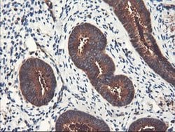 PFKP Monoclonal Antibody (OTI2E8), TrueMAB , OriGene 30 &mu;L; Unconjugated:Antibodies,
