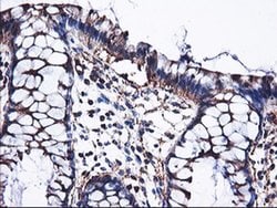 PFKP Monoclonal Antibody (OTI2E8), TrueMAB , OriGene 30 &mu;L; Unconjugated:Antibodies,