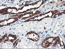 PFKP Monoclonal Antibody (OTI2E8), TrueMAB , OriGene 30 &mu;L; Unconjugated:Antibodies,