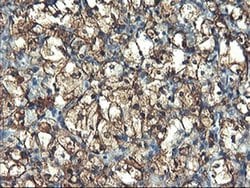 PFKP Monoclonal Antibody (OTI2E8), TrueMAB , OriGene 30 &mu;L; Unconjugated:Antibodies,