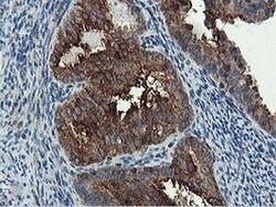 PFKP Monoclonal Antibody (OTI1A11), TrueMAB , OriGene 30 &mu;L; Unconjugated:Antibodies,
