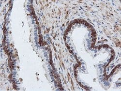 PFKP Monoclonal Antibody (OTI1A11), TrueMAB , OriGene 30 &mu;L; Unconjugated:Antibodies,