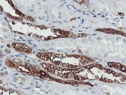 PFKP Monoclonal Antibody (OTI1A11), TrueMAB , OriGene 30 &mu;L; Unconjugated:Antibodies,