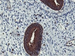 PFKP Mouse anti-Human, Clone: OTI5F7, lyophilized, TrueMAB 100 &mu;g; Unconjugated:Antibodies,
