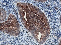 PFKP Mouse anti-Human, Clone: OTI5F7, lyophilized, TrueMAB 100 &mu;g; Unconjugated:Antibodies,
