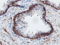 PFKP Mouse anti-Human, Clone: OTI5F7, lyophilized, TrueMAB 100 &mu;g; Unconjugated:Antibodies,