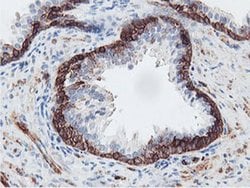PFKP Monoclonal Antibody (OTI5F7), TrueMAB , OriGene 100 &mu;L; Unconjugated:Antibodies,