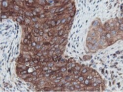 PFKP Mouse anti-Human, Clone: OTI5F7, lyophilized, TrueMAB 100 &mu;g; Unconjugated:Antibodies,