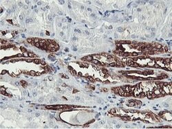 PFKP Mouse anti-Human, Clone: OTI5F7, lyophilized, TrueMAB 100 &mu;g; Unconjugated:Antibodies,