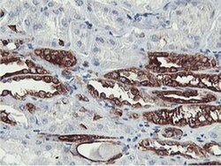 PFKP Monoclonal Antibody (OTI5F7), TrueMAB , OriGene 100 &mu;L; Unconjugated:Antibodies,