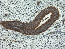 PFKP Mouse anti-Human, Clone: OTI2F2, lyophilized, TrueMAB 100 &mu;g; Unconjugated:Antibodies,