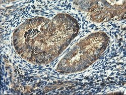 PFKP Mouse anti-Human, Clone: OTI2F2, lyophilized, TrueMAB 100 &mu;g; Unconjugated:Antibodies,