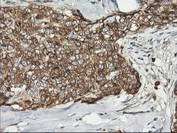 PFKP Mouse anti-Human, Clone: OTI2F2, lyophilized, TrueMAB 100 &mu;g; Unconjugated:Antibodies,