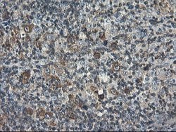 PFKP Mouse anti-Human, Clone: OTI2F2, lyophilized, TrueMAB 100 &mu;g; Unconjugated:Antibodies,