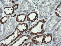 PFKP Mouse anti-Human, Clone: OTI2F2, lyophilized, TrueMAB 100 &mu;g; Unconjugated:Antibodies,