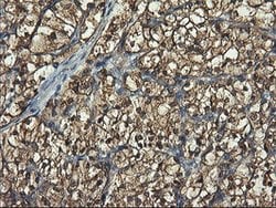 PFKP Mouse anti-Human, Clone: OTI2F2, lyophilized, TrueMAB 100 &mu;g; Unconjugated:Antibodies,