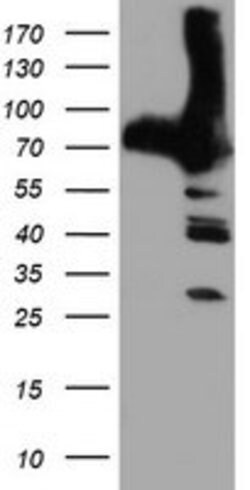 PFKP Mouse anti-Human, Clone: OTI1F2, lyophilized, TrueMAB 100 &mu;g; Unconjugated:Antibodies,