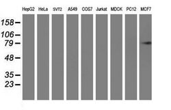 PFKP Mouse anti-Human, Clone: OTI1F2, lyophilized, TrueMAB 100 &mu;g; Unconjugated:Antibodies,