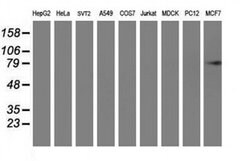 PFKP Mouse anti-Human, Clone: OTI1F2, liquid, TrueMAB 100 &mu;L; Unconjugated:Antibodies,