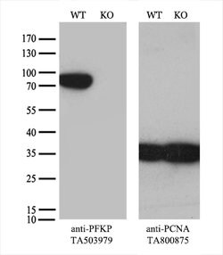 PFKP Mouse anti-Human, Clone: OTI1F2, lyophilized, TrueMAB 100 &mu;g; Unconjugated:Antibodies,