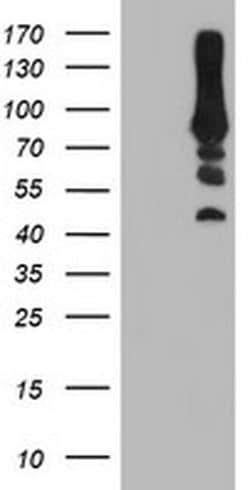 PFKP Monoclonal Antibody (OTI3A12), TrueMAB , OriGene 100 &mu;L; Unconjugated:Antibodies,