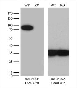 PFKP Monoclonal Antibody (OTI3A12), TrueMAB , OriGene 100 &mu;L; Unconjugated:Antibodies,