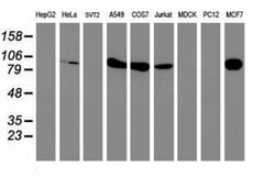 PFKP Monoclonal Antibody (OTI2E10), TrueMAB , OriGene 100 &mu;L; Unconjugated:Antibodies,