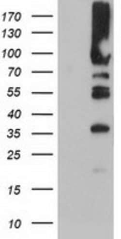 PFKP Mouse anti-Human, Mouse, Rat, Clone: OTI1D6, lyophilized, TrueMAB 100 &mu;g | Buy Online | Origene Technologies | Fisher Scientific