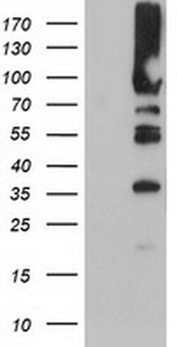 PFKP Mouse anti-Human, Mouse, Rat, Clone: OTI1D6, liquid, TrueMAB 100 &mu;L;