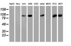 PFKP Mouse anti-Human, Mouse, Rat, Clone: OTI1D6, liquid, TrueMAB 100 &mu;L;