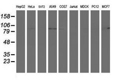 PFKP Mouse anti-Human, Clone: OTI3G8, lyophilized, TrueMAB 100 &mu;g; Unconjugated:Antibodies,