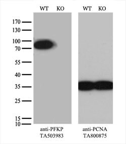 PFKP Mouse anti-Human, Clone: OTI3G8, lyophilized, TrueMAB 100 &mu;g; Unconjugated:Antibodies,