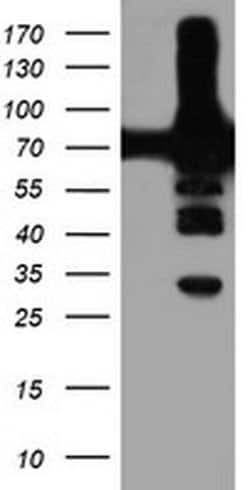 PFKP Monoclonal Antibody (OTI2E8), TrueMAB , OriGene 30 &mu;L; Unconjugated:Antibodies,