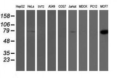 PFKP Monoclonal Antibody (OTI2E8), TrueMAB , OriGene 30 &mu;L; Unconjugated:Antibodies,