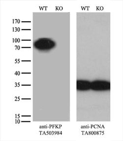 PFKP Monoclonal Antibody (OTI2E8), TrueMAB , OriGene 30 &mu;L; Unconjugated:Antibodies,