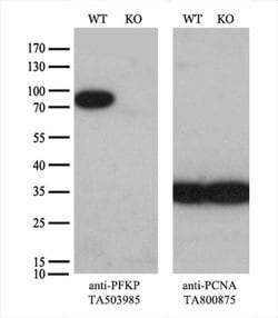 PFKP Monoclonal Antibody (OTI1A11), TrueMAB , OriGene 30 &mu;L; Unconjugated:Antibodies,