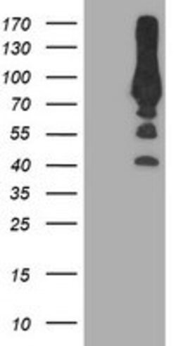 PFKP Mouse anti-Human, Clone: OTI5F7, lyophilized, TrueMAB 100 &mu;g; Unconjugated:Antibodies,