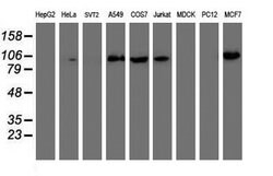 PFKP Mouse anti-Human, Clone: OTI5F7, lyophilized, TrueMAB 100 &mu;g; Unconjugated:Antibodies,