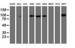 PFKP Monoclonal Antibody (OTI5F7), TrueMAB , OriGene:Antibodies:Primary