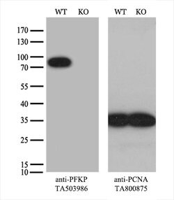 PFKP Mouse anti-Human, Clone: OTI5F7, lyophilized, TrueMAB 100 &mu;g; Unconjugated:Antibodies,