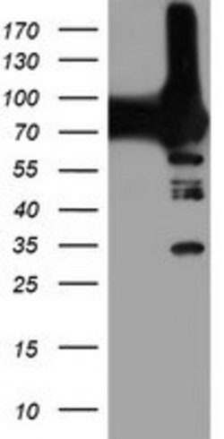 PFKP Mouse anti-Human, Clone: OTI2F2, lyophilized, TrueMAB 100 &mu;g; Unconjugated:Antibodies,