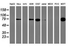 PFKP Mouse anti-Human, Clone: OTI2F2, lyophilized, TrueMAB 100 &mu;g; Unconjugated:Antibodies,
