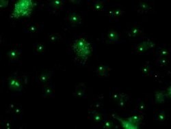 PGAM2 Monoclonal Antibody (OTI4H1), TrueMAB , OriGene:Antibodies:Primary