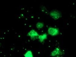 PGAM2 Monoclonal Antibody (OTI3B11), TrueMAB , OriGene 30 &mu;L; Unconjugated:Antibodies,