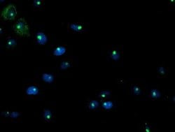 PGAM2 Monoclonal Antibody (OTI1C11), TrueMAB , OriGene 100 &mu;L; Unconjugated:Antibodies,