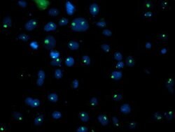 PGAM2 Mouse anti-Human, Clone: OTI1C2, lyophilized, TrueMAB 100 &mu;g;