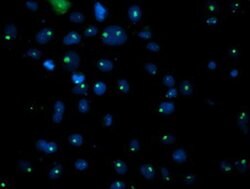 PGAM2 Monoclonal Antibody (OTI1C2), TrueMAB , OriGene 100 &mu;L; Unconjugated:Antibodies,
