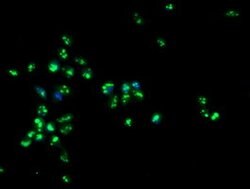PGAM2 Mouse anti-Human, Clone: OTI1C2, lyophilized, TrueMAB 100 &mu;g;