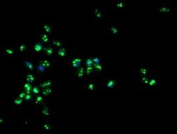 PGAM2 Monoclonal Antibody (OTI1C2), TrueMAB , OriGene 100 &mu;L; Unconjugated:Antibodies,