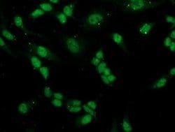 PGAM2 Monoclonal Antibody (OTI4E9), TrueMAB , OriGene 30 &mu;L; Unconjugated:Antibodies,
